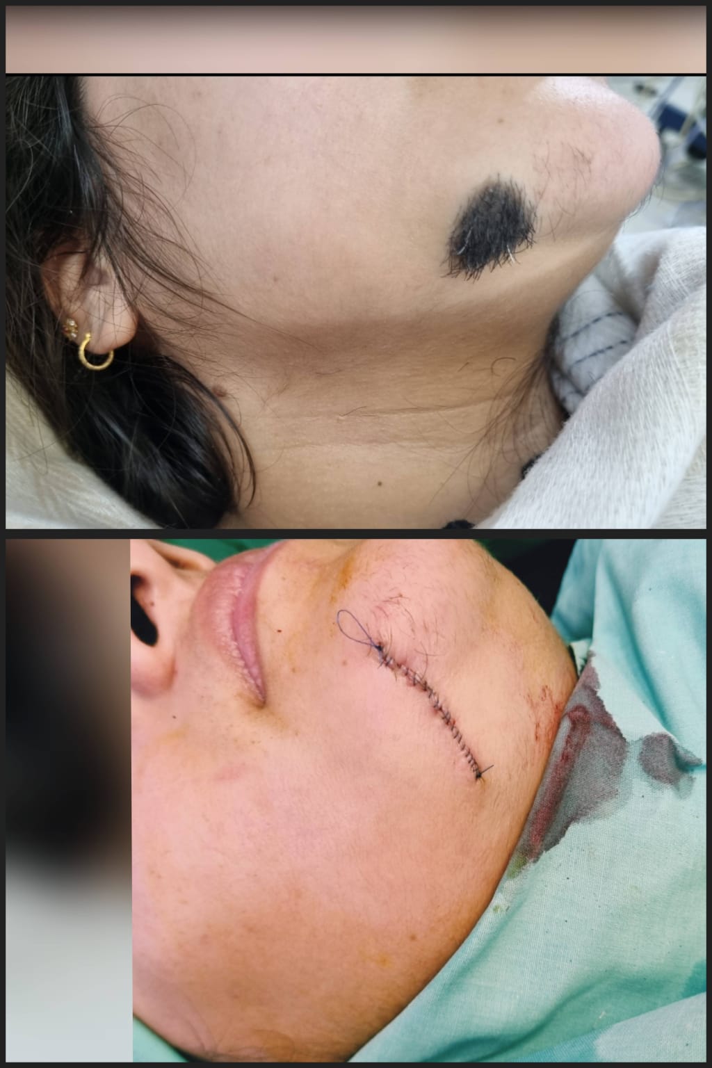 Before & After 62